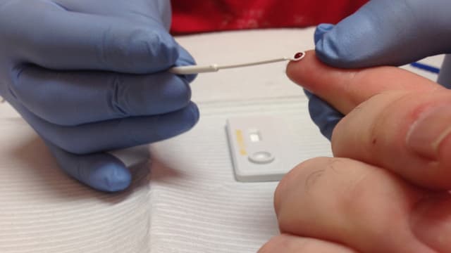 Les tests de séropositivité seront proposés dans certains services d'urgence.