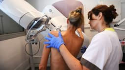 Une mammographie pour le dépistage du cancer du sein. Image d'illustration.