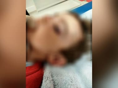 Ismaïl, deux ans, a été attaqué par un rat dans un logement social du Havre