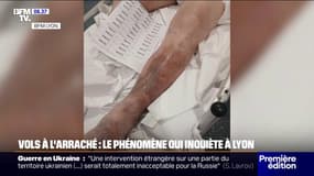 Lyon: recrudescence des vols à l'arraché 