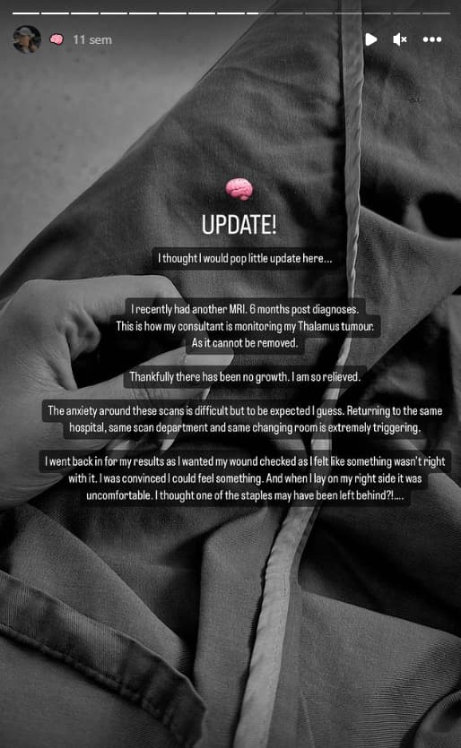 Laura Mangan exprimait son soulagement de constater que la tumeur n'évoluait pas, en septembre dernier Laura Mangan exprimait son soulagement de constater que la tumeur n'évoluait pas, en septembre dernier