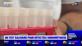 Santé : un test salivaire développé à Lyon pour détecter l'endométriose