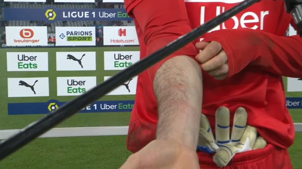 Pau Lopez touché sur le premier but lyonnais lors d'OM-OL. Pau Lopez touché sur le premier but lyonnais lors d'OM-OL.