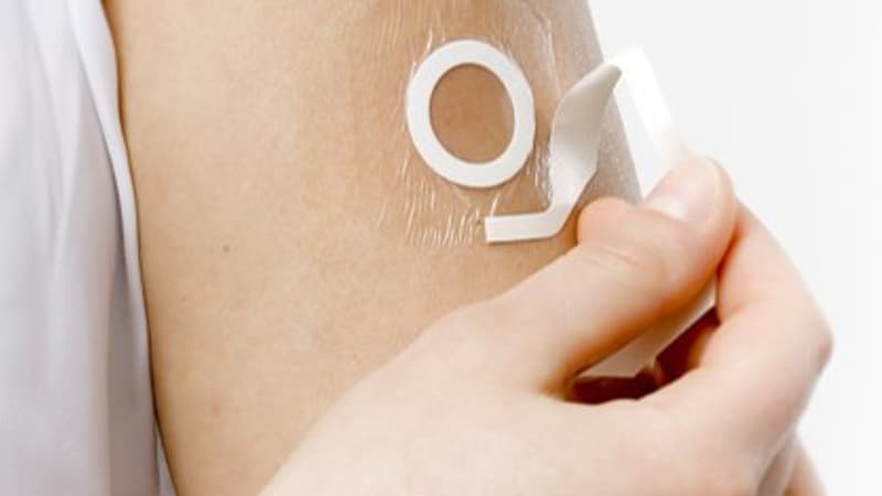 Le patch Viaskin pourrait apporter un tout premier traitement contre les allergies alimentaires.