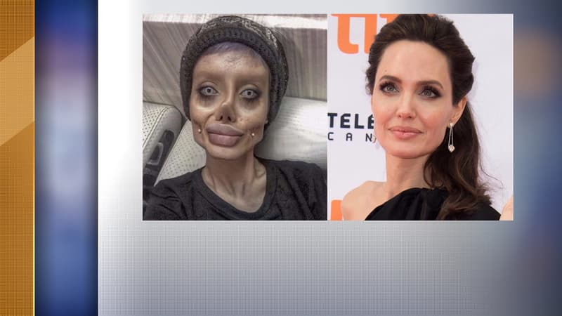 Sahar Tabar est prête à tout pour ressembler à Angelina Jolie