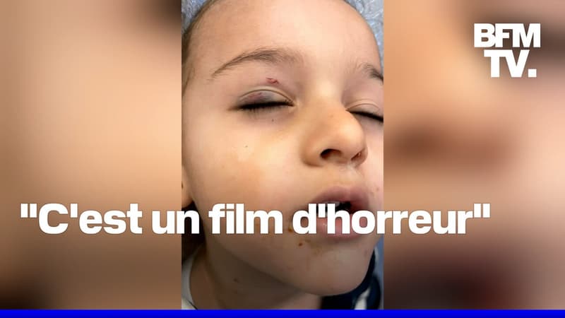 À Cannes, un enfant endormi se fait mordre par un rat en pleine nuit