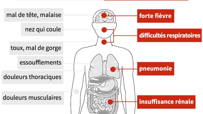 Les symptômes du coronavirus.