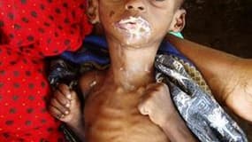 Un bébé souffrant de malnutrition dans les bras de sa mère à l'hôpital Banadir de Mogadiscio.