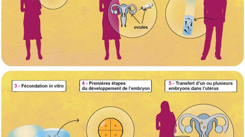 Explications des techniques de PMA de la FIV et de l'insémination artificielle Explications des techniques de PMA de la FIV et de l'insémination artificielle