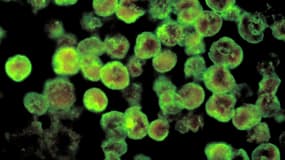 La Naegleria Fowleri s'introduit par le nez et remonte au cerveau.