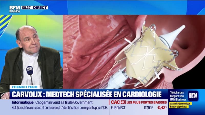 Medtech spécialisée en cardiologie