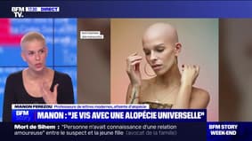 "On a l'impression de n'avoir aucune maîtrise sur ce qui nous arrive": atteinte d’alopécie, Manon Ferezou témoigne