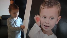 Né avec une seule oreille, Nolan a besoin de dons pour mieux entendre.