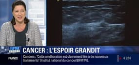 Cancer: La durée de vie s'améliore en France