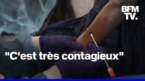 Mpox: un premier cas du nouveau variant clade 1b détecté en France 