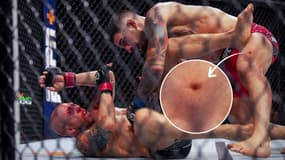Le trou présent dans la jambe gauche d'Ilia Topuria, lors de son combat à l'UFC, le 24 juin 2023.