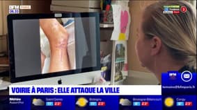 Paris: victime d'une fracture ouverte après une chute à vélo, une femme attaque la ville de Paris en justice