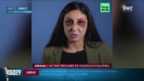 "Ils m’ont tabassé au sol": une femme accuse des policiers de l'avoir passé à tabac à Créteil