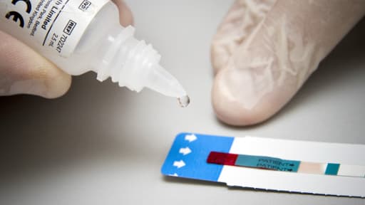 Un médecin effectue un test rapide de dépistage du VIH