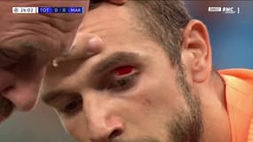 Pau Lopez contre Tottenham