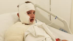 Mohammad, 11 ans, a été brûlé dans une frappes israélienne au Liban.