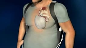 Infographie montrant le fonctionnement du coeur artificiel produit par la société Carmat.