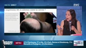 Bientôt un remède contre la calvitie?