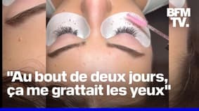 Allergies, démangeaisons: les ophtalmologistes alertent à l'installation d'extensions de cils mal fabriquées 