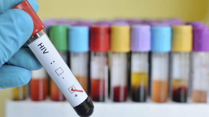 Des tests de dépistage du VIH - Image d'illustration