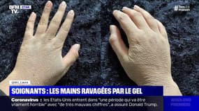 Les mains des soignants sont ravagées par le gel hydroalcoolique