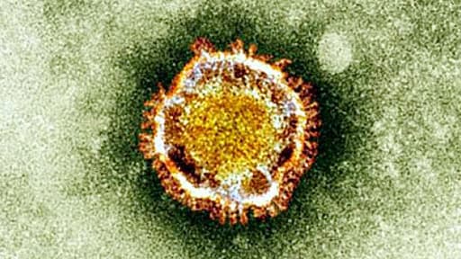 Les patients suspectés de porter le coronavirus à Tours ne sont en fait pas porteurs du virus, annonce le ministère de la Santé.