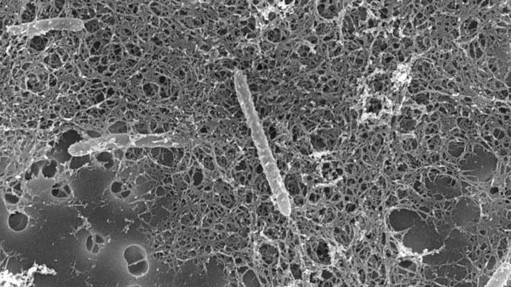 Desulforudis audaxviator dans les profondeurs de la terre, dans le noir complet et sans oxygène.