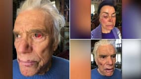 "Ils ont pris beaucoup de coups": le fils de Bernard Tapie raconte l'agression subie par son père et sa belle-mère