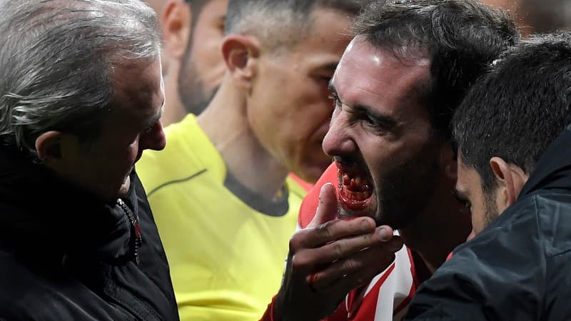 Diego Godin blessé