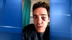 Alexandre, client UberPop agressé: "J'ai pris plusieurs coups au visage"