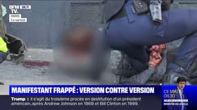 Manifestant frappé samedi: sa version s'oppose à celle de la police