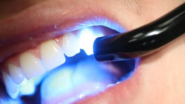 L'impression 3D se perfectionne de jour en jour. Aujourd'hui des objets, demain, des dents.