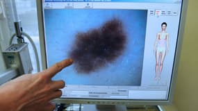Une dermatologue explique à une patiente à l'aide d'un logiciel l'évolution d'un grain de beauté, le 4 décembre 2008 à Quimper (illsutration)