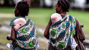 L'albinisme touche environ une personne sur 1200 au Malawi.