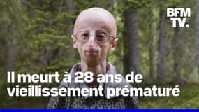 À 28 ans, Sammy Basso, le plus vieux malade au monde atteint de vieillissement prématuré est mort