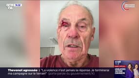 Isère: "Je prends un coup de poing parce que je colle une affiche, c'est triste dans une démocratie" raconte Bernard Dupré, militant pour Ensemble