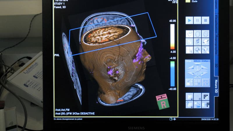 Quarante patients pédophiles ont pris part à une étude sur le cerveau.