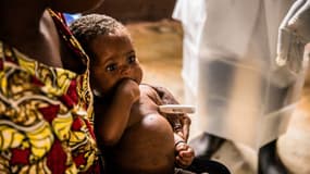 Un enfant infecté par la variole du singe, à Zomea Kaka, en République centrafricaine le 18 octobre 2018 (photo d'illustration)