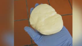 La jeune femme transportait 1 kg de cocaïne dans ses seins