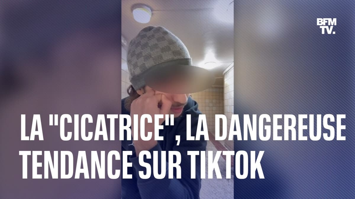 Se créer une cicatrice sur le visage le nouveau jeu dangereux des ados — free download