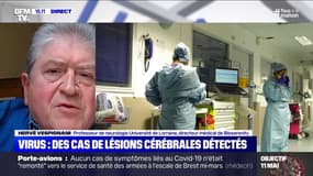 Selon une étude, le coronavirus peut provoquer des lésions cérébrales