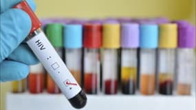 VIH: une patiente en rémission après une allogreffe, une première en France