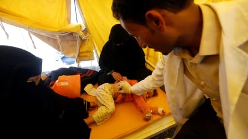 Un enfant infecté par le choléra reçoit un traitement dans un hôpital de Sanaa, le 13 juin 2017