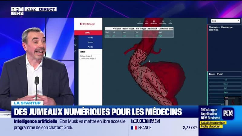 Bruno Virieux (Predisurge) : Predisurge aide à la préparation des chirurgies cardiovasculaires - 12/03