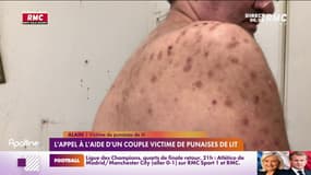 Alain, victime de punaises de lit